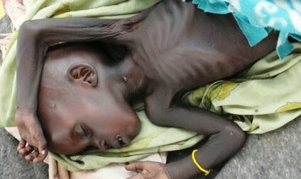 A past picture of a child dying of starvation in the Nuba Mountains. (Courtesy photo)