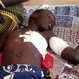 One of the gunshot victims is admitted to the Rumbek State Hospital. (Photo: Radio Tamazuj)