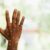 Lakes State declares Mpox outbreak among prison inmates