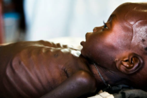 UN: Upper Nile fighting puts 60,000 malnourished children at greater risk 