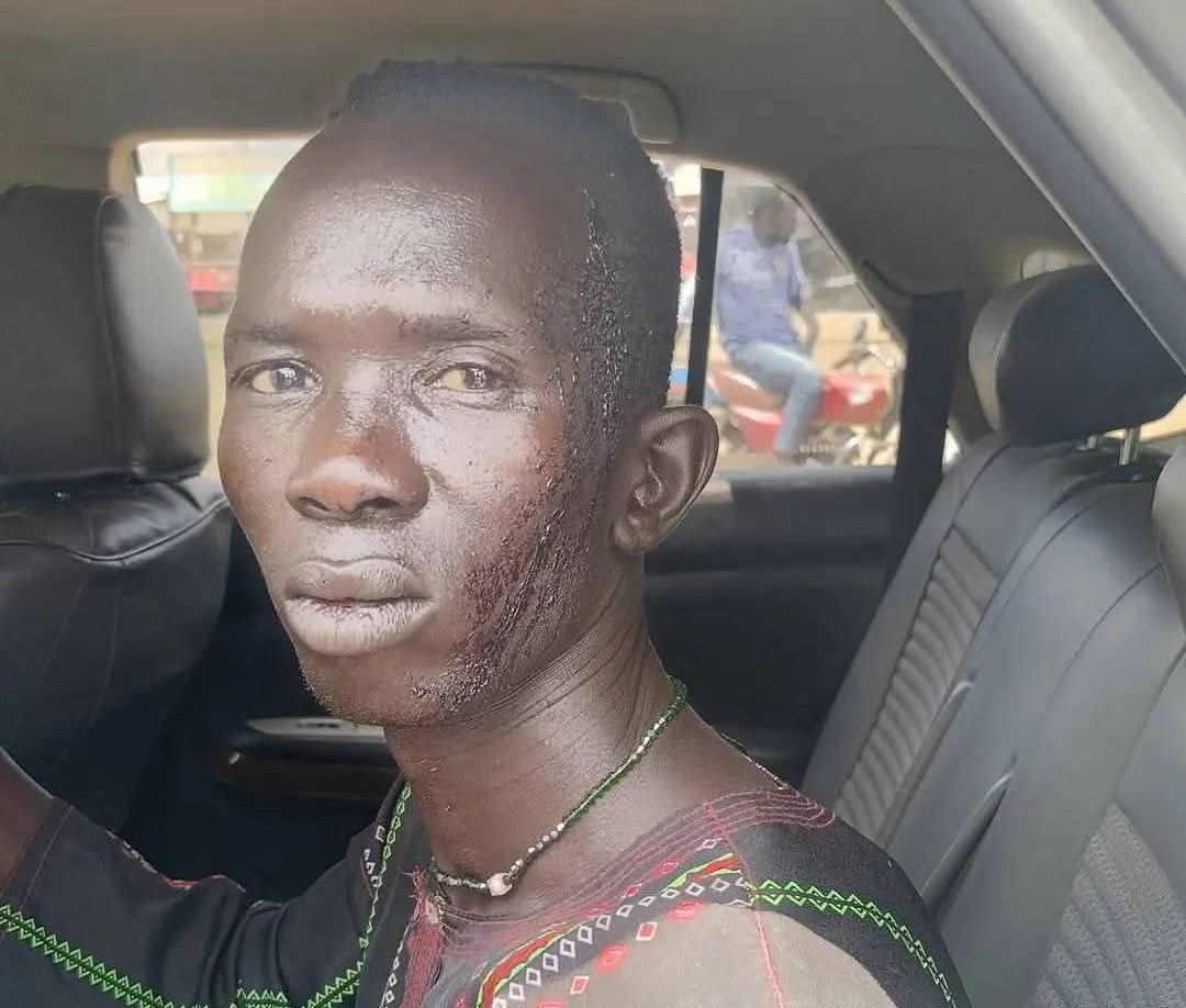 Attack on Juba-Bor Highway injures 2