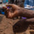 Ezo County reports three Mpox cases