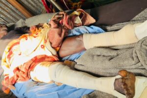 Displaced in Akobo describe killings and burned homes