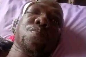 W. Bahr el Ghazal lawmaker hospitalized after night attack